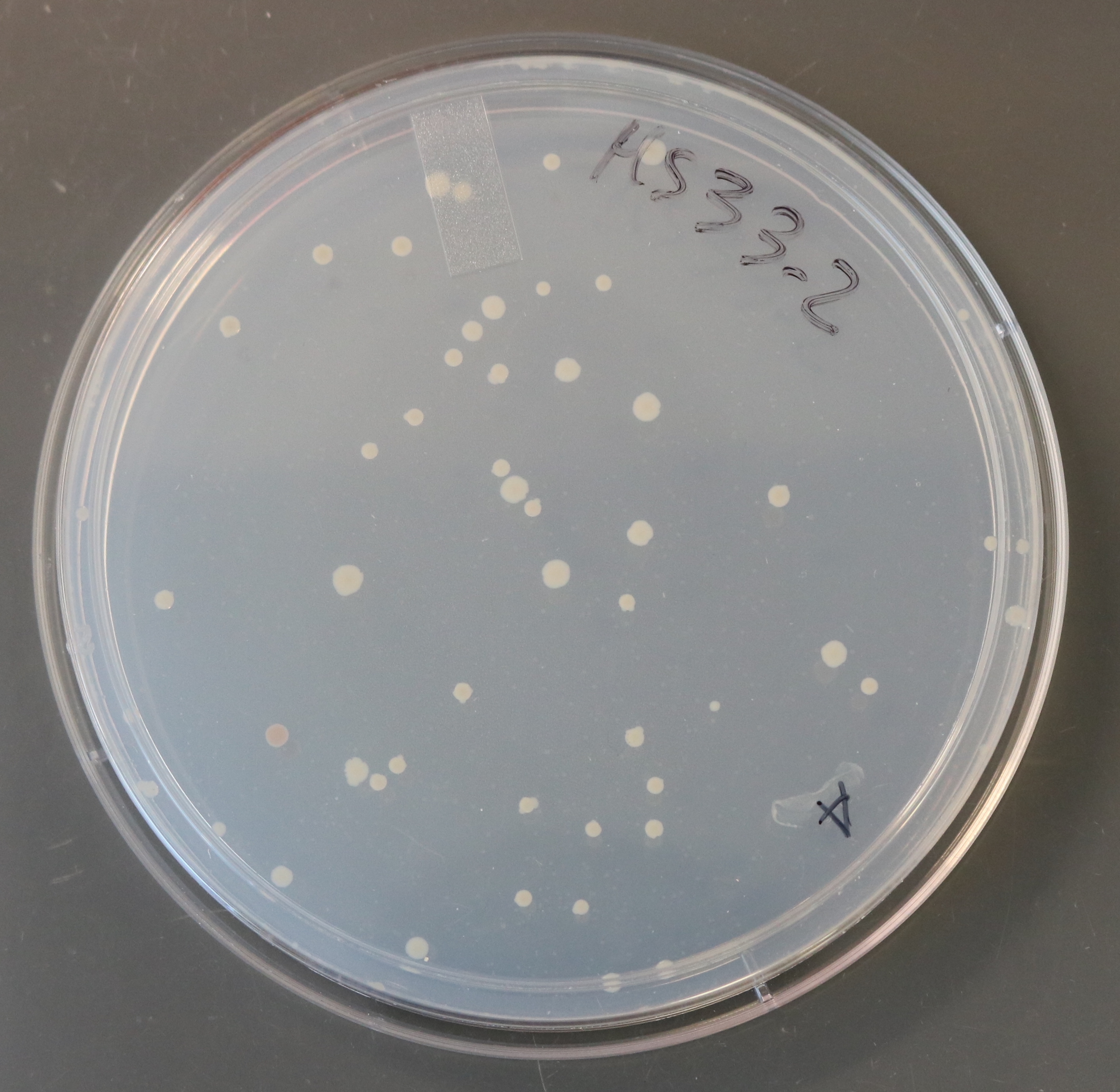 E. lenta colonies isolated from a healthy subject